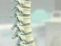 ǿֱԼʲô֢״.jpg